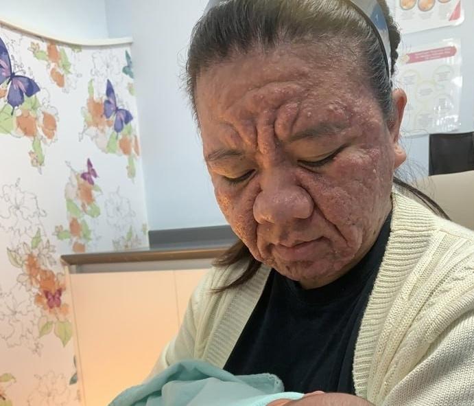 😱 Во время беременности у девушки резко ухудшилось состояние кожи, что сделало её внешность старше на несколько лет.