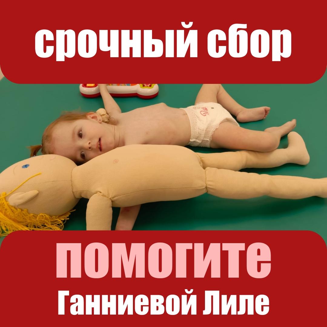 Жизнь началась с реанимации. Крошка Лиля родилась и перестала дышать. Перенесла операцию и кровоизлияние. Отзовитесь!