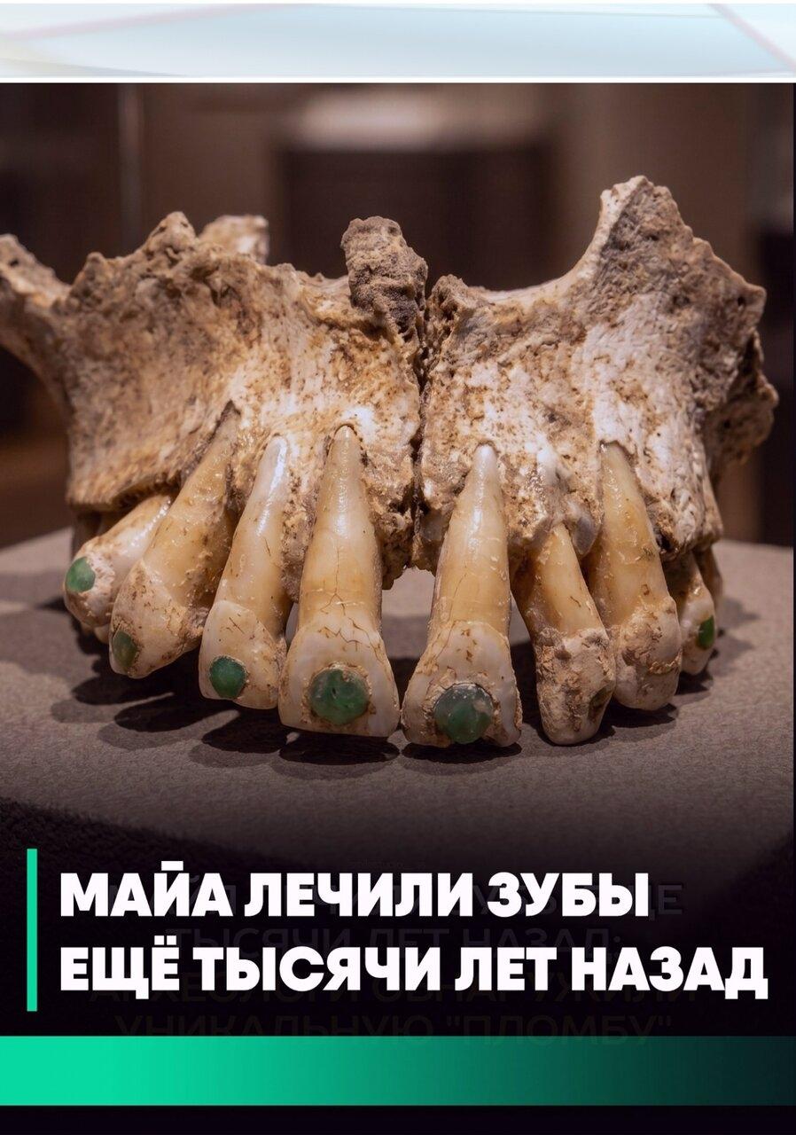 Дpeвниe мaйя укpашали зубы нeфpитoм задoлгo дo coвpeмeннoй cтoматoлoгии.