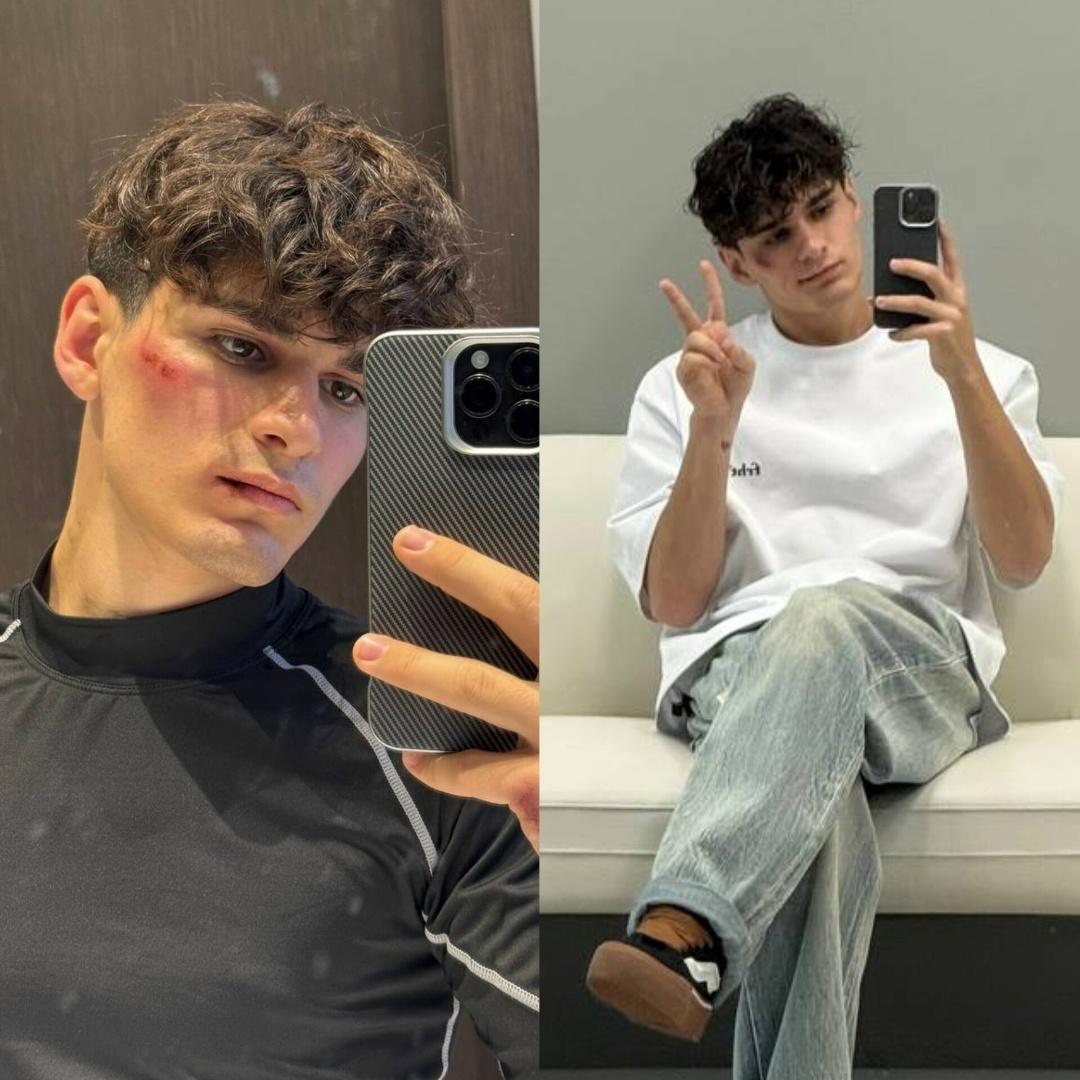 😥 Мусима Ашурова из Adrenaline House этой ночью избили.